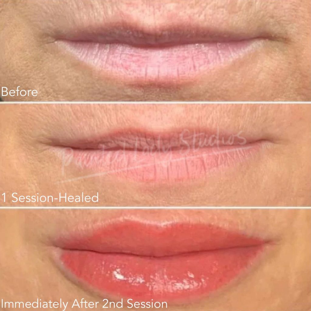 Before and after lip tattoo results showing enhanced lip color and definition at Painted Lady Studios in Syracuse NY.